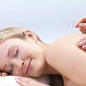 Medical Acupuncture