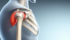 Common shoulder injuries in sports
