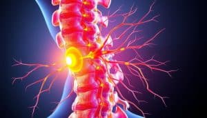 A detailed anatomical illustration of central sensitization in the nervous system of an athlete. Depict the spinal cord and surrounding nerve fibers, with vibrant colors and textures to convey the heightened sensitivity and pain response. Showcase the hyper-excitability of the dorsal horn neurons, with neural pathways radiating outward from the spine. Employ a scientific, medical illustration style, with minimal background clutter to focus on the physiological mechanisms. Capture the sensation of altered pain perception and amplified discomfort that can manifest in athletes dealing with chronic pain conditions.